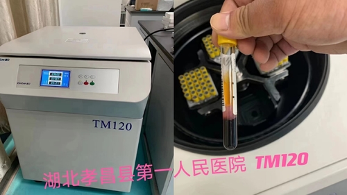 Latest company news about PRP-centrigue